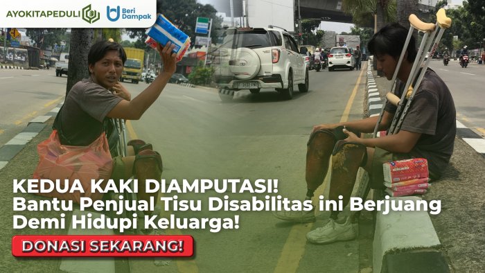 KEDUA KAKI DIAMPUTASI! Bantu Penjual Tisu Disabilitas ini Berjuang Demi Hidup Keluarganya!!