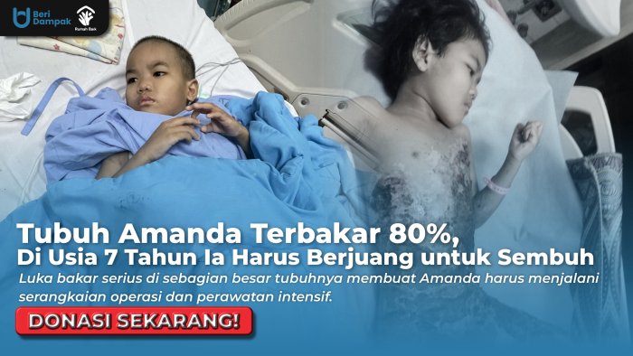 TUBUH AMANDA TERBAKAR HEBAT! Bantu Ia Segera Jalani Operasi