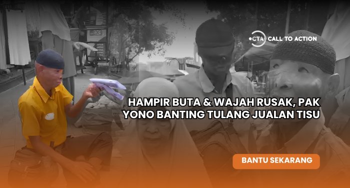 Mata Rusak Kena Air Keras, Pak Yono Bertahan dari Untung Seribu