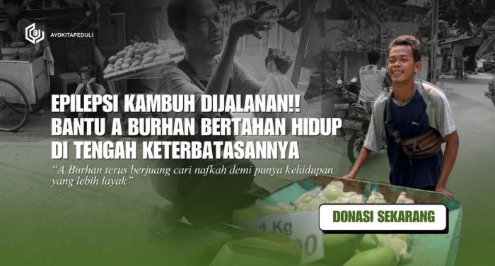 DIHINA DAN DIJAUHI!! Fisik A Burhan Sering Jadi Bahan Ejekan Hingga Dikatain Jijik