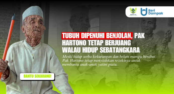 Mengidap Penyakit Langka! Lansia Penjaga Mesjid Berjuang Lawan Benjolannya