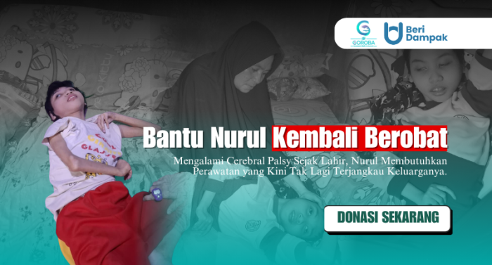 Bantu Perawatan Nurul! Anak dengan Cerebral Palsy yang Terkendala Biaya