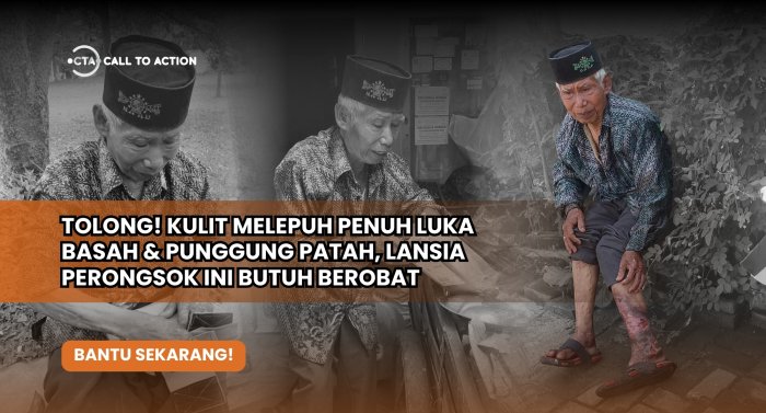 Bantu Abah Merongsok yang Menahan Kaki Busuk