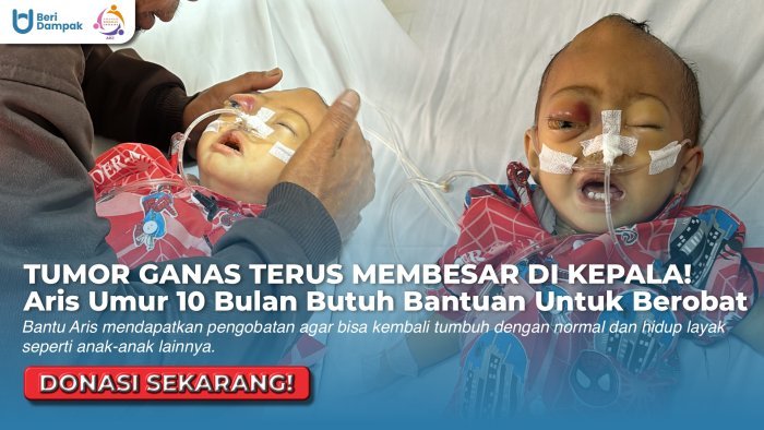 MENANGIS KESAKITAN!! Bantu Dek Aris Agar Bisa Segera Obati Tumornya