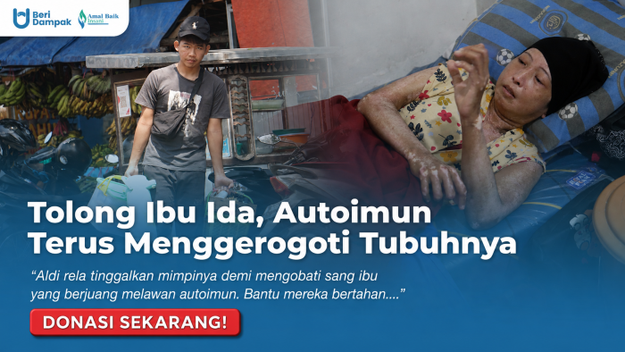 Badan Ibu Melepuh Dan Kaku! Bantu Aldi Berjuang Jual Kopi Keliling Demi Ibunya Yang Sakit Autoimun!