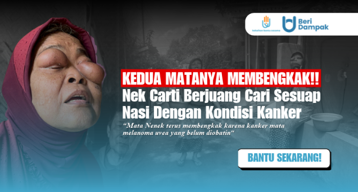 MATA MEMBENGKAK!! Nenek Penjual Gorengan Ini Berjuang Cari Biaya Makan Dan Berobat Sendirian