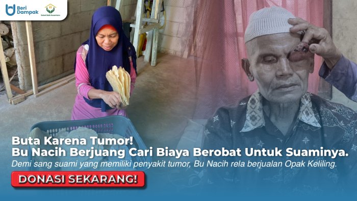 BUTA KARENA TUMOR! Bu Nacih Rela Jualan Opak Demi Suaminya Bisa Berobat