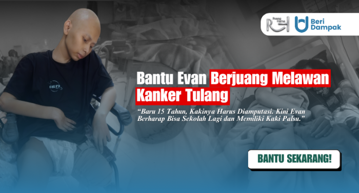 WUJUDKAN HARAPAN EVAN! Anak Pengidap Kanker Tulang Memiliki Kaki Palsu