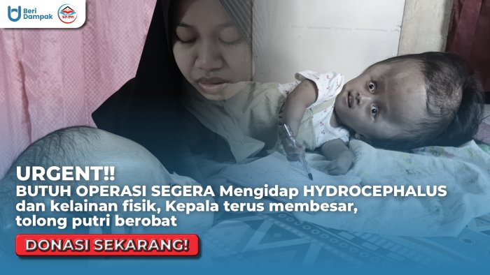 Putri 4 Tahun Terbaring dengan Kepala Membesar, Kaki Bengkok & Benjolan di Bokong, Bantu Ia Berobat
