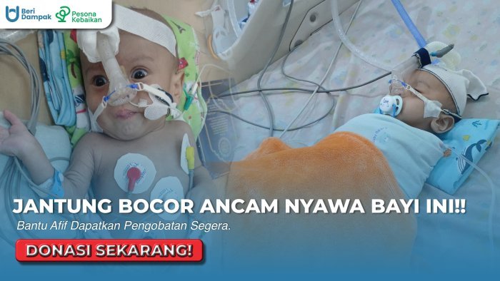Jantung Bocor Sejak Usia 19 Hari, Kini Afif 9 Bulan Berjuang Mengejar Berat Badan Demi Operasi Kedua