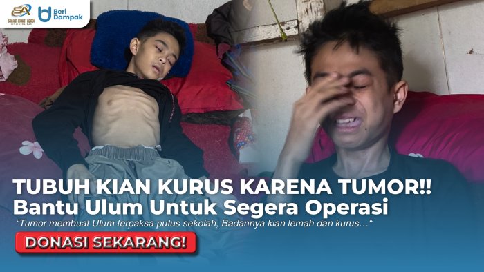 PUTUS SEKOLAH KARENA TUMOR!! Bantu Patungan Agar Ulum Bisa Dioperasi