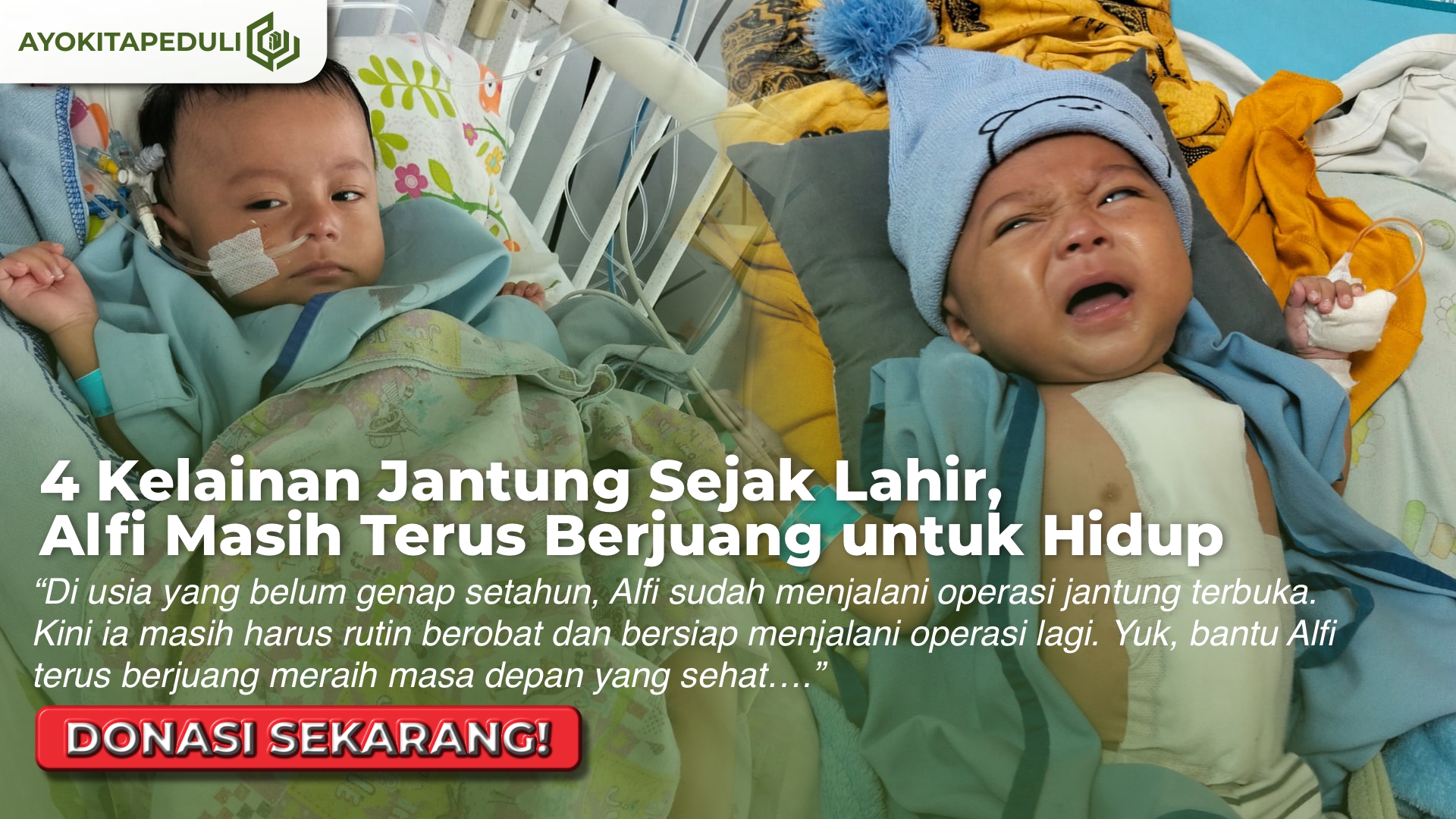 USIA 11 BULAN!!! Alfi Harus Berjuang Melawan Penyakit Empat Jantung Langka
