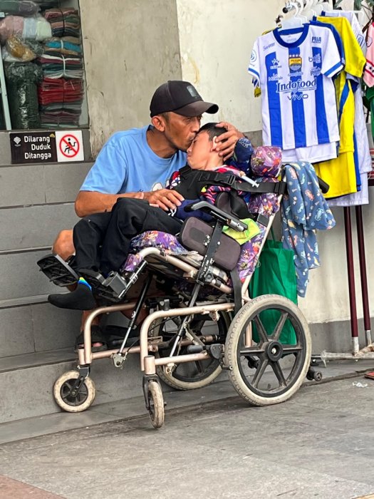 MENGIDAP CEREBRAL PALSY!! Bantu Dek Akmal Supaya Bisa Terus Terapi