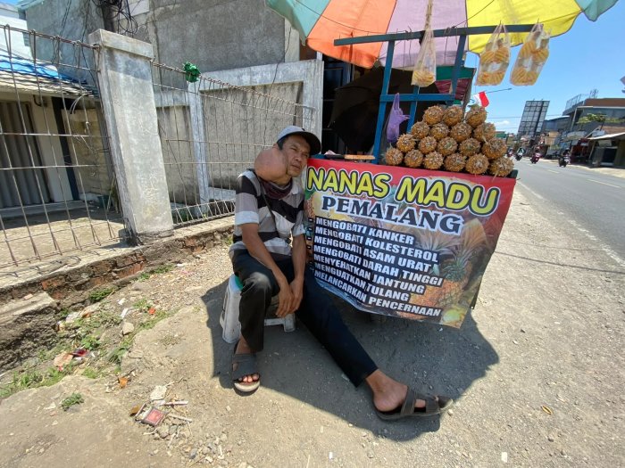 Sakit Kanker 18 Tahun. Pak Sambas Rela Tidak Berobat Demi Bisa Anak Dan Istri Makan!!!