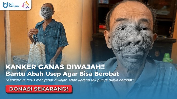 KANKER SEMAKIN PARAH!! Bantu Abah Usep Agar Dapat Pengobatan Segera