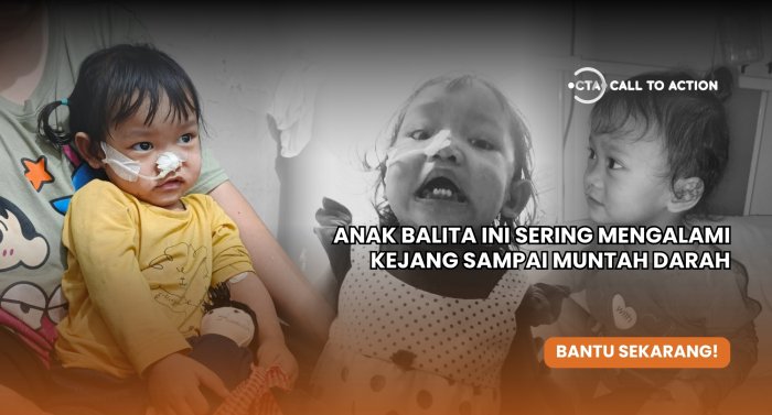 Bantu Hana! Nyawanya Terancam Karena Epilepsi Berat Hingga Kejang Setiap Hari