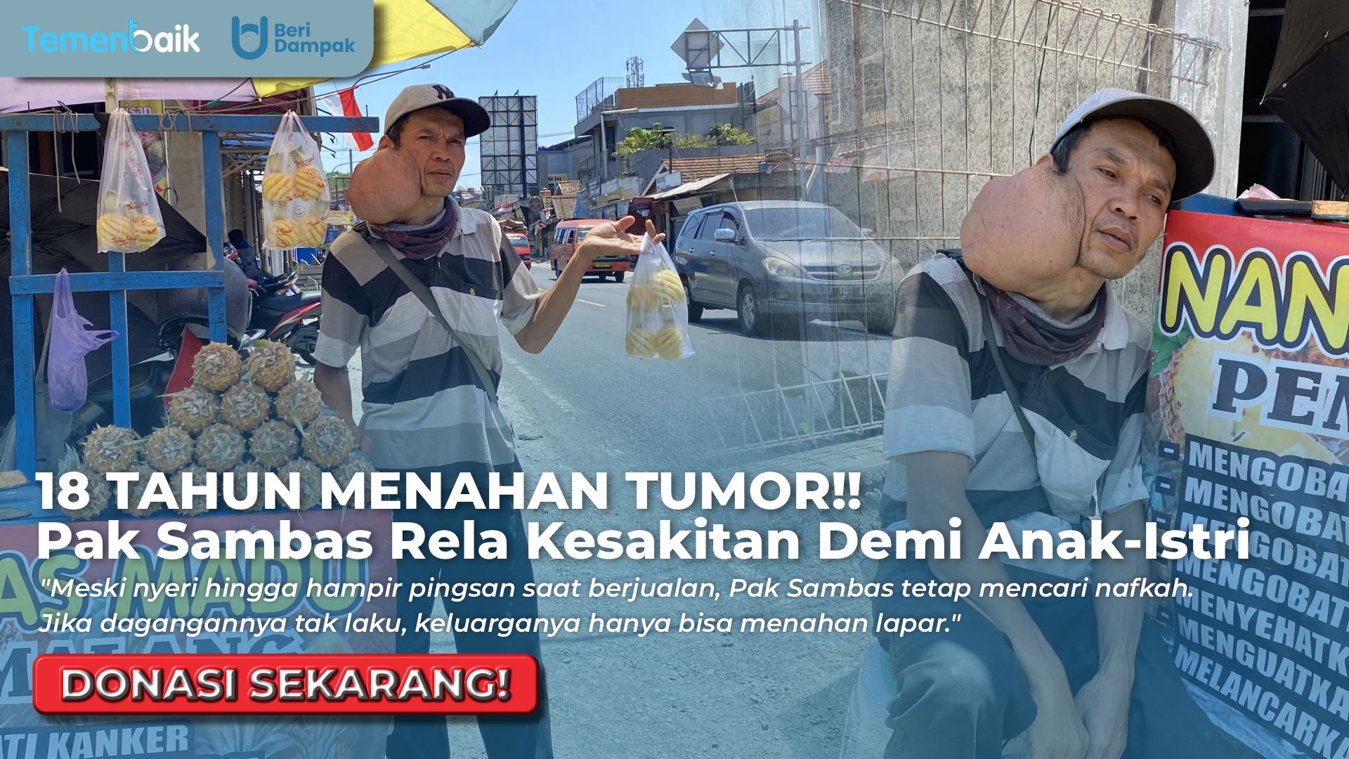 Sakit Kanker 18 Tahun. Pak Sambas Rela Tidak Berobat Demi Bisa Anak Dan Istri Makan!!!