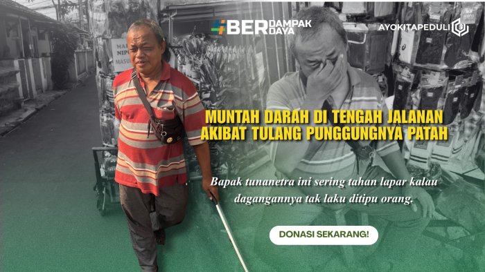 Buta Akibat Glaukoma, Bantu Pak Agus Sekarang!
