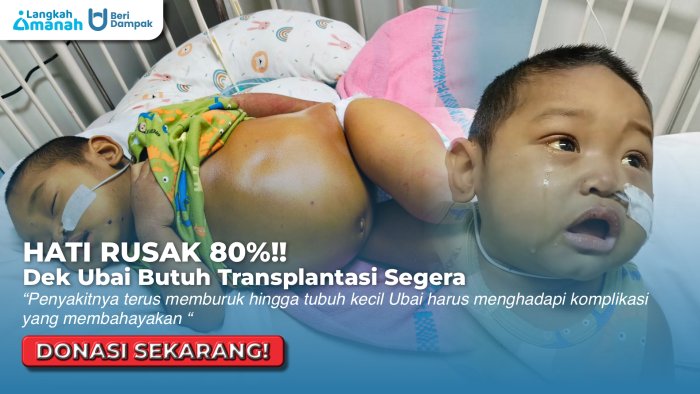 BUTUH TRANSPLANTASI HATI!! Bantu Ubai Agar Bisa Sembuh Dari Penyakit Langka