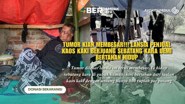 Pedih!!! Jual Kaos Kaki Demi Obati Kanker Sendirian